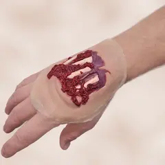 Techline Technologies Degloved Hand