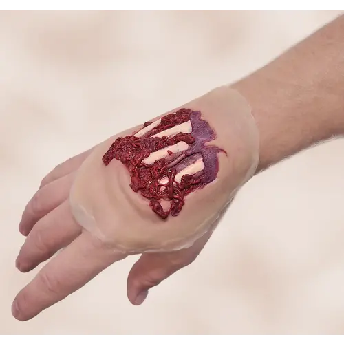 Techline Technologies Degloved Hand