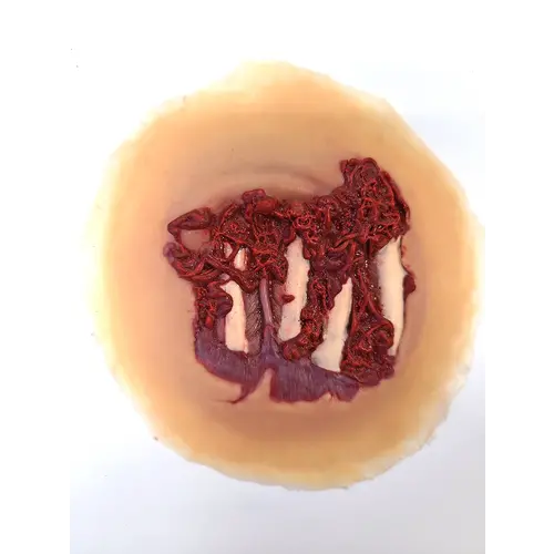 Techline Technologies Degloved Hand