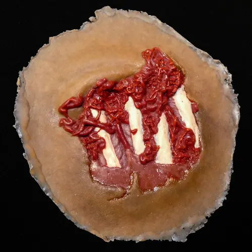 Techline Technologies Degloved Hand