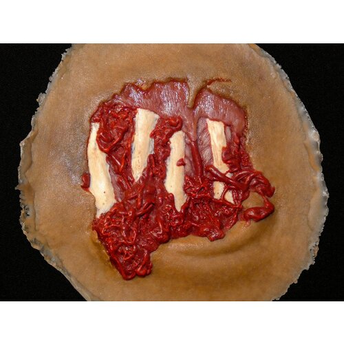 Techline Technologies Degloved Hand