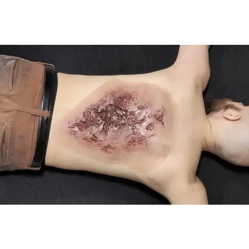 Techline Technologies Large Torso Burn