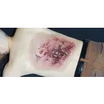 Techline Technologies Large Torso Burn