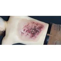 Techline Technologies Large Torso Burn