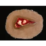 Techline Technologies Compound Fracture