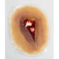 Techline Technologies Compound Fracture