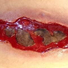 Techline Technologies Electrical Burn - Large