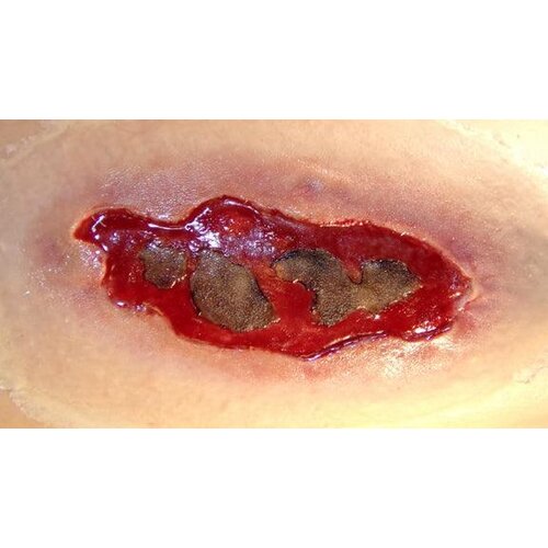 Techline Technologies Electrical Burn - Large