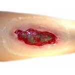 Techline Technologies Electrical Burn - Large