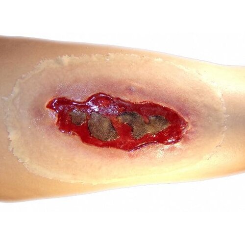 Techline Technologies Electrical Burn - Large