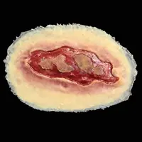 Techline Technologies Electrical Burn - Large