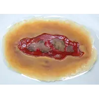 Techline Technologies Electrical Burn - Large