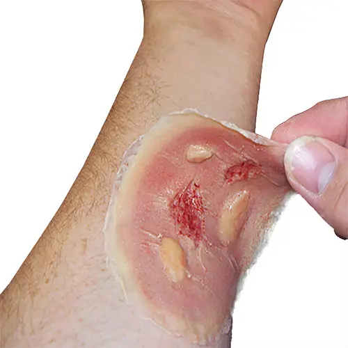 Techline Technologies Thermal Burn - Medium