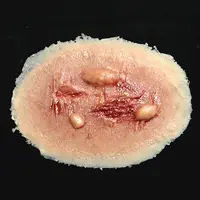 Techline Technologies Thermal Burn - Medium