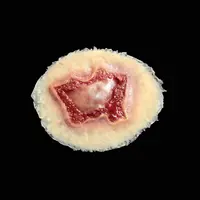 Techline Technologies Chemical Burn - Medium