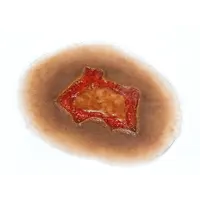 Techline Technologies Chemical Burn - Medium