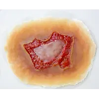 Techline Technologies Chemical Burn - Medium