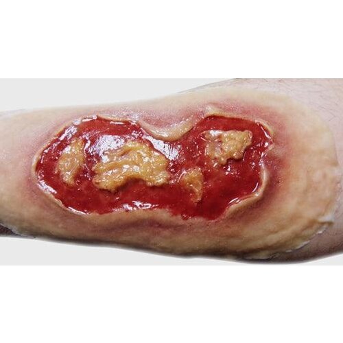 Techline Technologies Electrical Burn - Medium