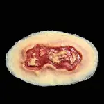 Techline Technologies Electrical Burn - Medium