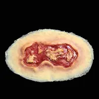 Techline Technologies Electrical Burn - Medium