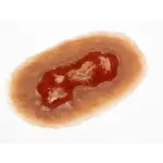 Techline Technologies Electrical Burn - Medium