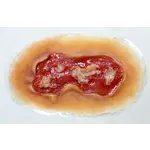 Techline Technologies Electrical Burn - Medium