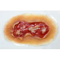 Techline Technologies Electrical Burn - Medium