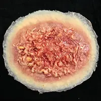 Techline Technologies Burn - 2nd Degree