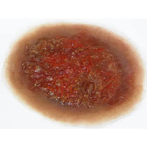 Techline Technologies Burn - 2nd Degree