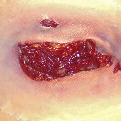 Techline Technologies Laceration - Large