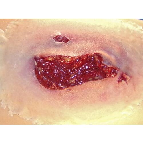 Techline Technologies Laceration - Large