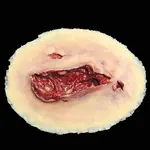 Techline Technologies Laceration - Large