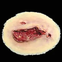 Techline Technologies Laceration - Large