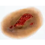 Techline Technologies Laceration - Large