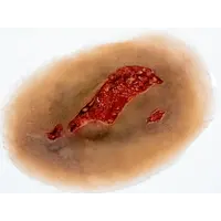 Techline Technologies Laceration - Large