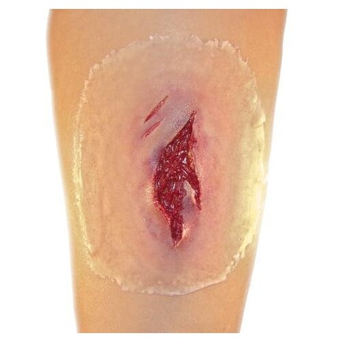 Techline Technologies Laceration - Medium