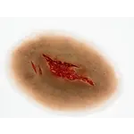 Techline Technologies Laceration - Medium