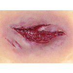 Techline Technologies Laceration - Medium
