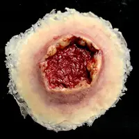 Techline Technologies GS Exit Wound - Large