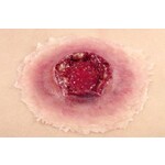 Techline Technologies GS Exit Wound - Large
