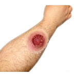 Techline Technologies GS Exit Wound - Large