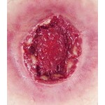 Techline Technologies GS Exit Wound - Large
