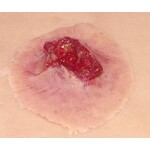 Techline Technologies GS Exit Wound - Medium