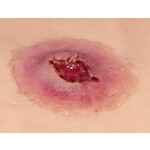 Techline Technologies GS Entry Wound - Large