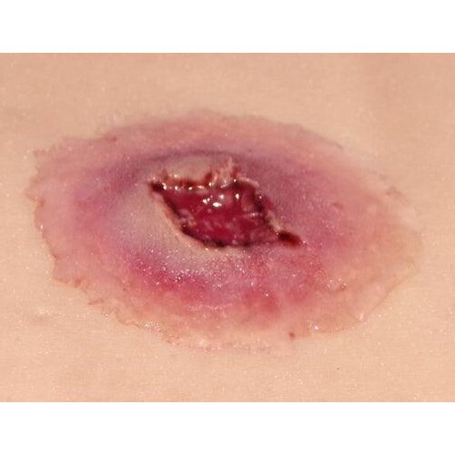 Techline Technologies GS Entry Wound - Large
