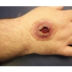 Techline Technologies GS Entry Wound - Large