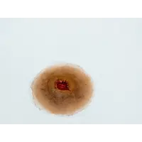 Techline Technologies GS Entry Wound - Large