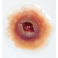 Techline Technologies GS Entry Wound - Large