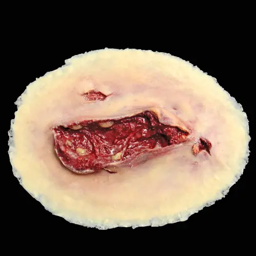 Techline Technologies Small Self Adhesive Wound Kit