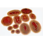 Techline Technologies Small Self Adhesive Wound Kit
